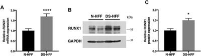 Overexpression of the Hsa21 Transcription Factor RUNX1 Modulates the Extracellular Matrix in Trisomy 21 Cells